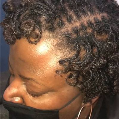 Micro-Locks Maintenance